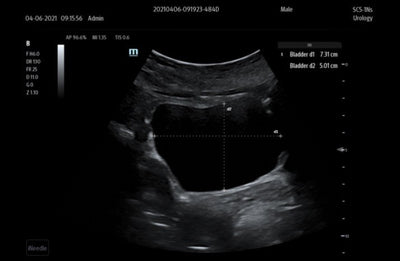 Mindray TE X Portable Ultrasound System