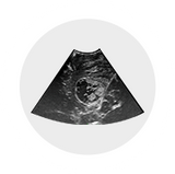 Fujifilm Ultrasound - Neurosurgery Arietta Precision