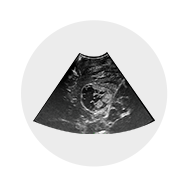 Fujifilm Ultrasound - Neurosurgery Arietta Precision