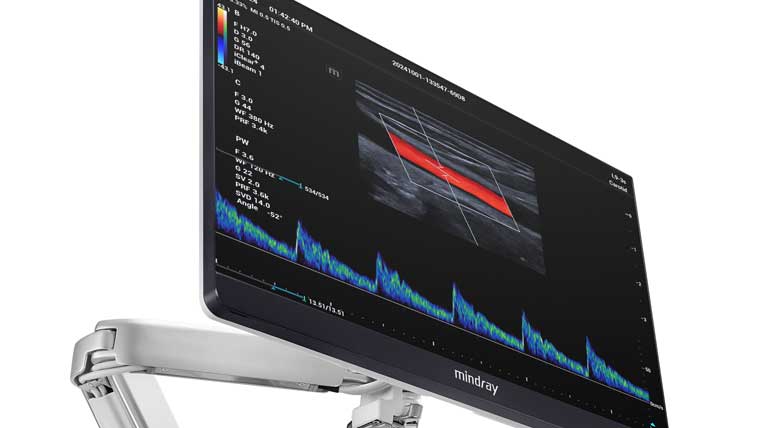Mindray Resona I8 Ultrasound Machine – MavenImaging