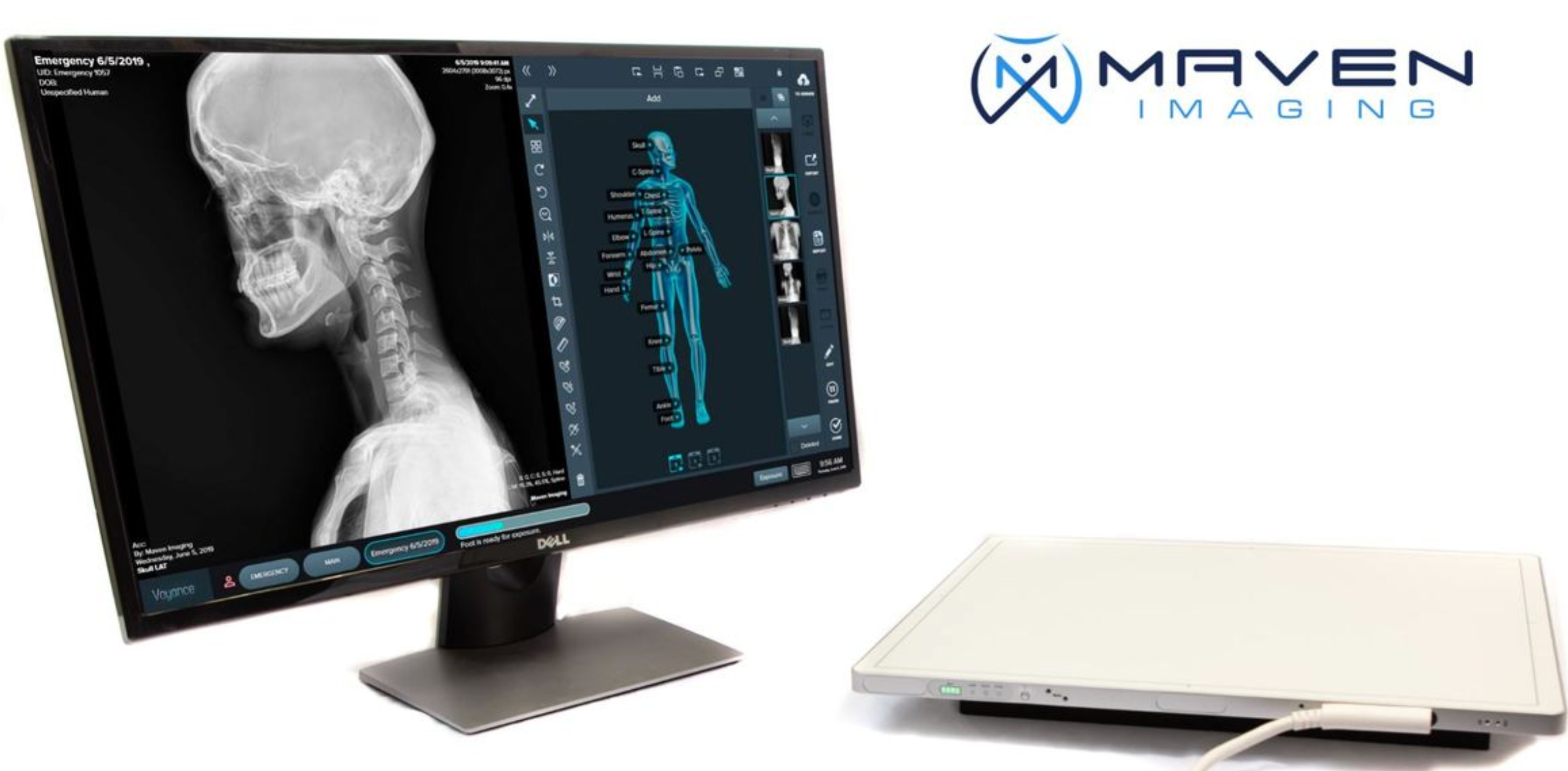 CT Machines for Sale - New and Refurbished – MavenImaging