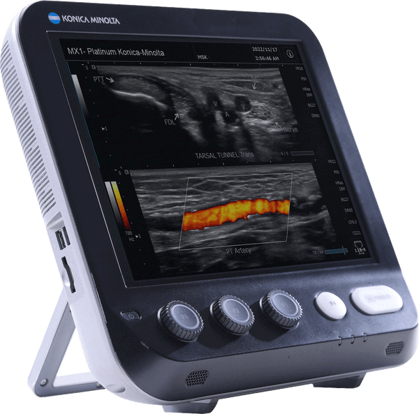 Sonimage MX1 Platinum