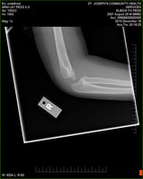 Fujifilm -  D-EVO Suite (OTCx & FSx)