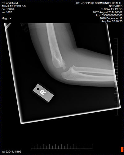 Fujifilm -  D-EVO Suite (OTCx & FSx)