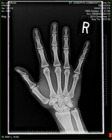 Fujifilm -  D-EVO Suite (OTCx & FSx)