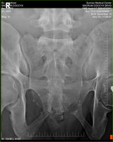 Fujifilm -  D-EVO Suite (OTCx & FSx)