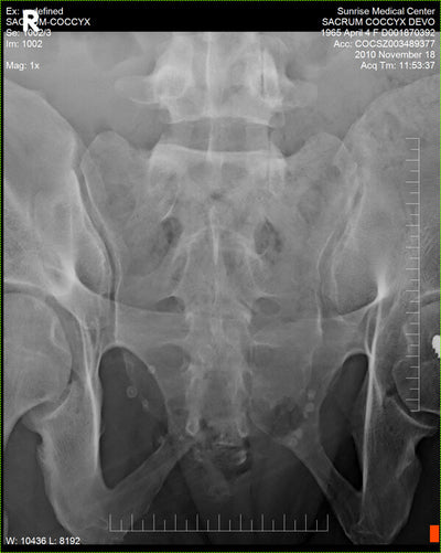 Fujifilm -  D-EVO Suite (OTCx & FSx)