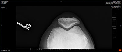 Fujifilm -  D-EVO Suite (OTCx & FSx)
