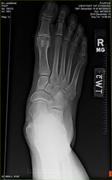 Fujifilm -  D-EVO Suite (OTCx & FSx)