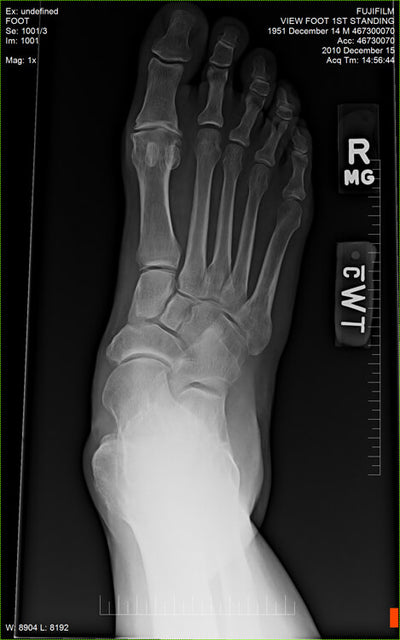 Fujifilm -  D-EVO Suite (OTCx & FSx)