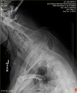 Fujifilm -  D-EVO Suite (OTCx & FSx)