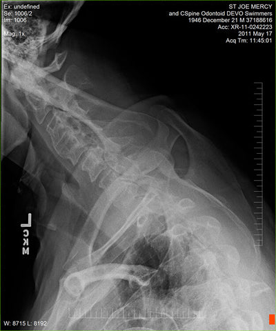 Fujifilm -  D-EVO Suite (OTCx & FSx)