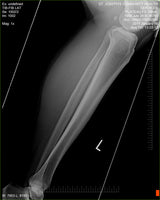 Fujifilm -  D-EVO Suite (OTCx & FSx)