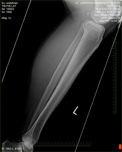 Fujifilm -  D-EVO Suite (OTCx & FSx)
