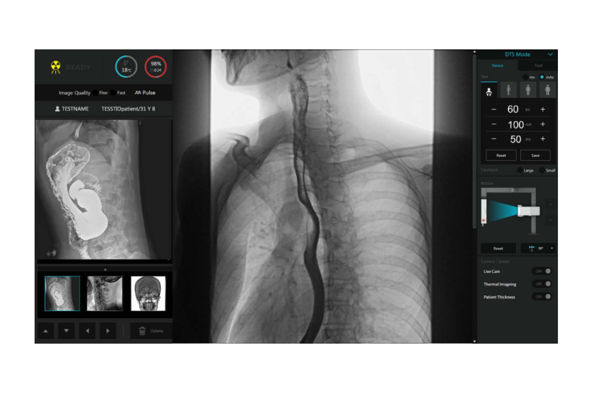 StriXion™ Smart Digital Multi-Modality System – MavenImaging