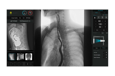 StriXion™ Smart Digital Multi-Modality System