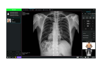 StriXion™ Smart Digital Multi-Modality System