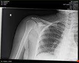 Fujifilm -  D-EVO Suite (OTCx & FSx)