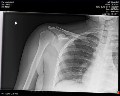 Fujifilm -  D-EVO Suite (OTCx & FSx)