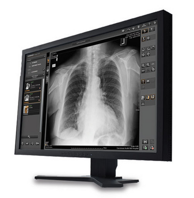 Carestream DRX Core - Digital X-ray System