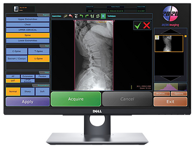 20/20 CFPH Hybrid 17x17 Chiropractic Direct Digital Imaging System - DR Panel