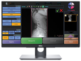 20/20 CFPT Tethered 17x17 Chiropractic Direct Digital Imaging System - DR Panel