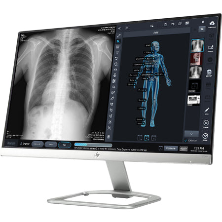 PatientImage 14x17 Wireless Flat Panel DR System – MavenImaging