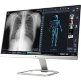 Patient Image - Flat Panel DR System 17 x 17 CSI Tethered