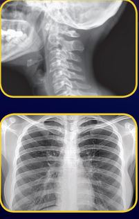 Radmedix Acuity 17 x 17 Gadox Digital X-ray Panel – MavenImaging