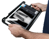 MinXray Portable X-ray System with Digital X-ray / DR Panel