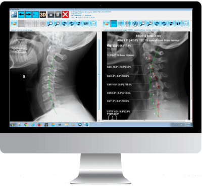 PostureRay® EMR software