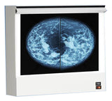 Mammography Double Film Illuminated View Box [Fluorescent Lamp]