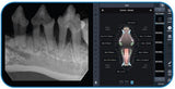 MasterDent: Veterinary Dental Digital X-ray Sensor with software