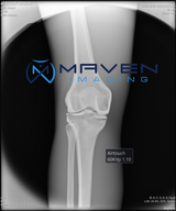Maven HandHeld X-ray