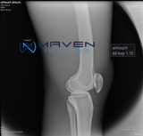 Maven HandHeld X-ray