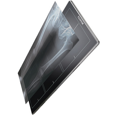 Fuji FDR D-EVO GL - Long length Digital X-ray