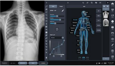 MasterX Chiropractic 17 x 17 CSI Tethered Digital X-ray / DR Panel