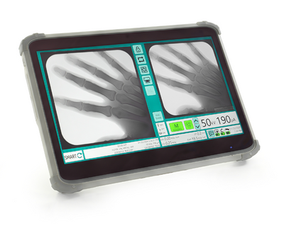 Portable X-Ray System Smart-C Arm